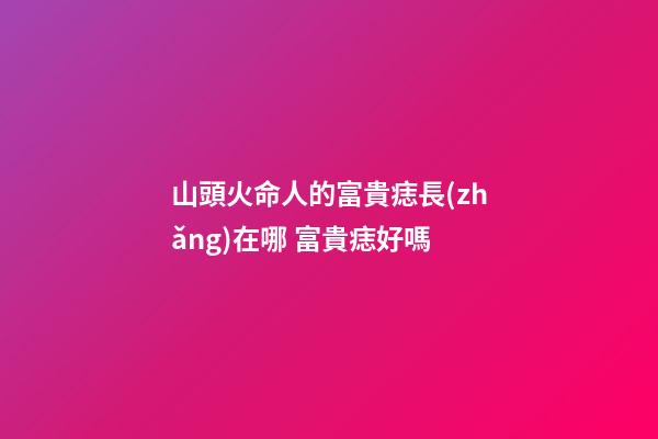 山頭火命人的富貴痣長(zhǎng)在哪 富貴痣好嗎